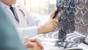 doctor and patient looking at a brain scan