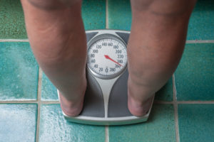 obesity