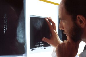 Man looking at an xray