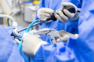 Endoscopy
